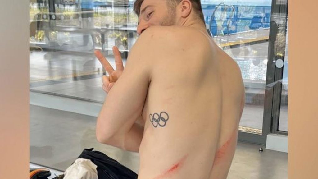 Alexis Jandard injured his back at the inauguration of the new Olympic Pool in Paris. Photo Credit: @alexis_jandard - Instagram